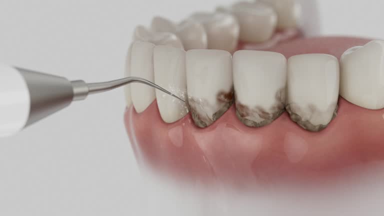 Trusted Emergency Dentist service in On Top of the World Designated Place, FL - Dentist Open Now
